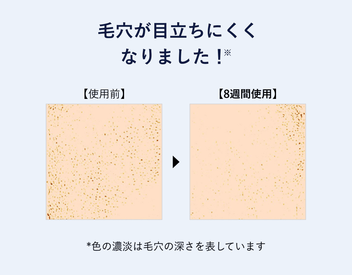 毛穴が目立ちにくくなりました！