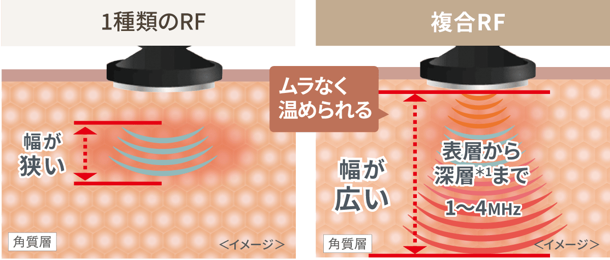 1種類のRF / 複合RF