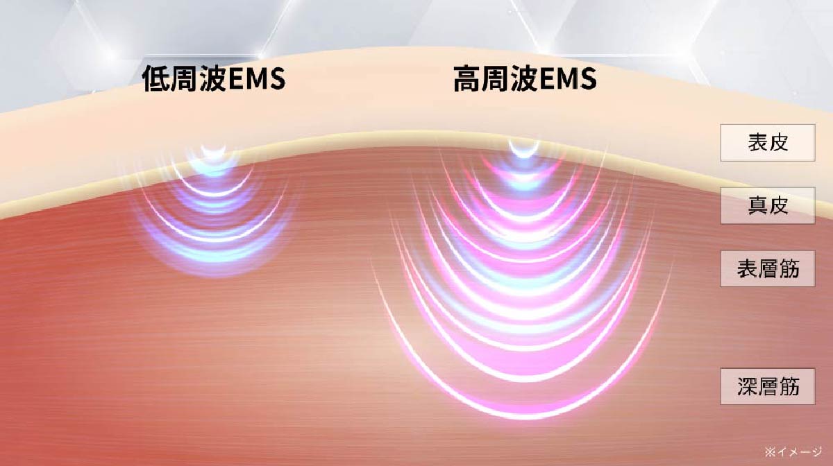 低周波EMS / 高周波EMSイメージ