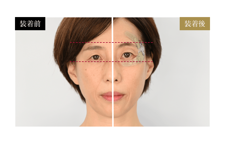 装着時の引き上がり比較／写真：装着前・装着後